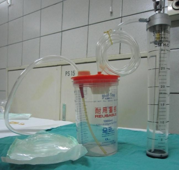 Gây dính màng phổi bằng thuốc/hóa chất qua ống dẫn lưu màng phổi